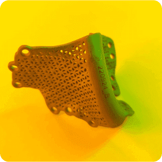 Щелепний імплант моделювання реконструкція виготовлення на 3D-принтері 3D Metal Tech 3д друк київ україна перший центр металевого 3D-друку українська медицина